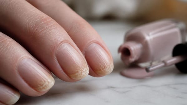 Smalto semipermanente e gel: i segnali precisi che indicano quando far respirare l'unghia